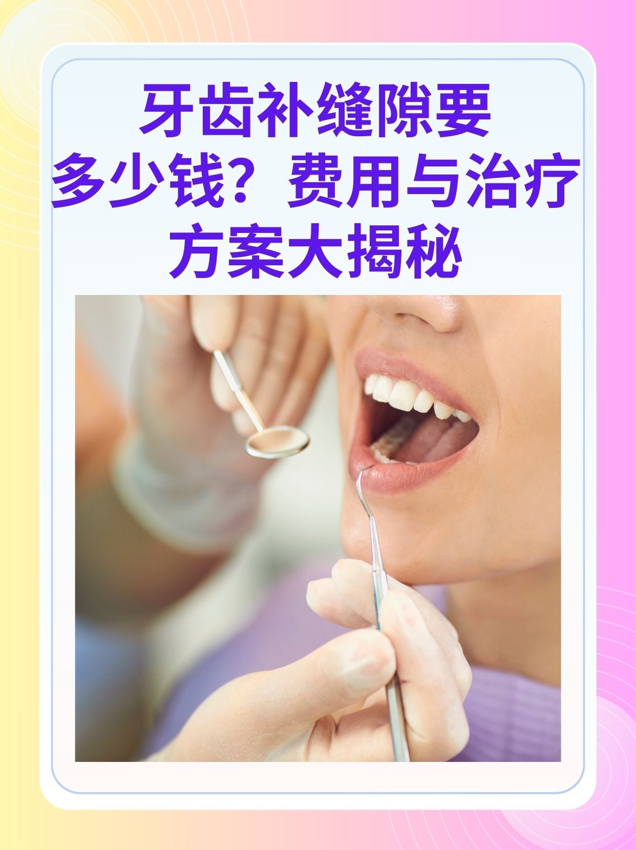 鹤壁补牙医保可以报销吗(补牙医保可以报销吗 哪些可以报销呢)